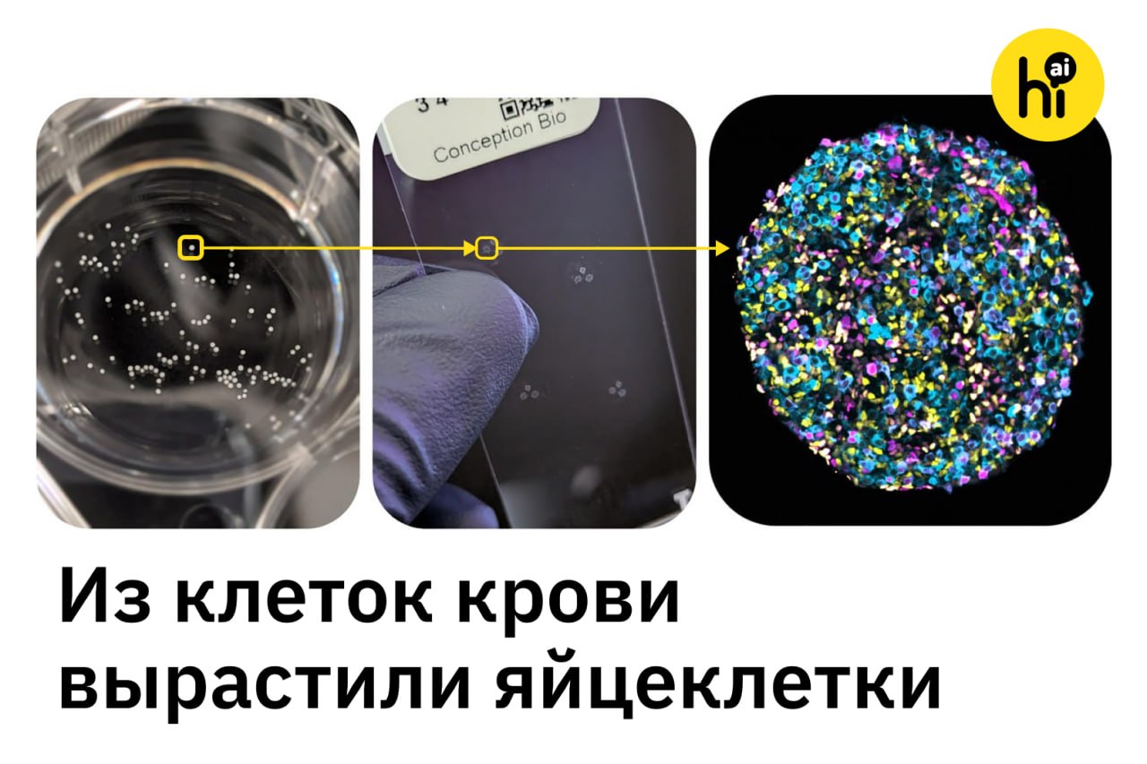Микроскопическое изображение фолликула с незрелой яйцеклеткой