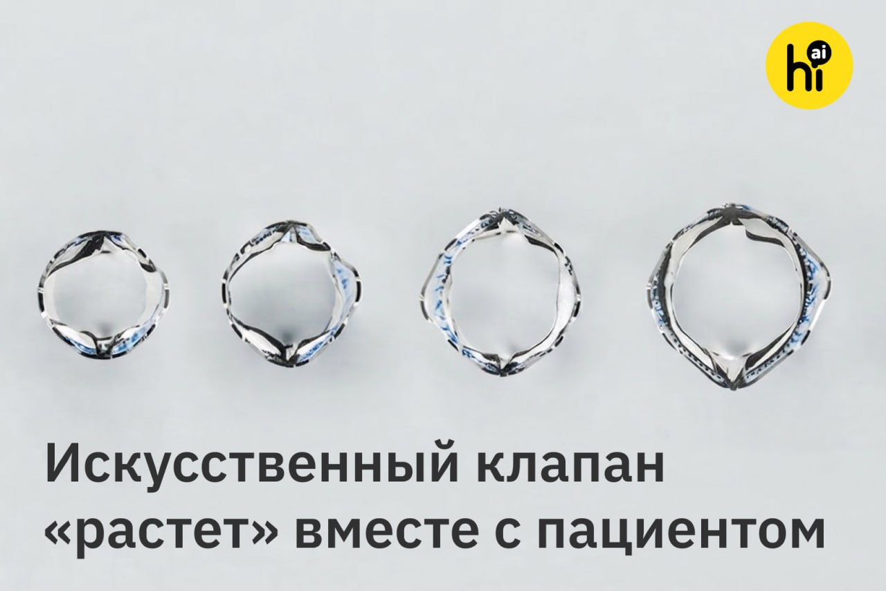 Детский кардиохирург держит инновационный клапан Autus
